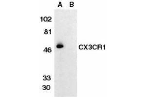 Western Blotting (WB) image for anti-Chemokine (C-X3-C Motif) Receptor 1 (CX3CR1) antibody (ABIN2473127) (CX3CR1 抗体)