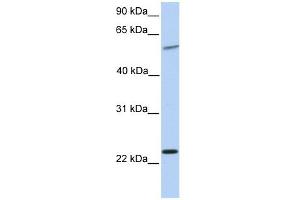 Synaptogyrin 2 antibody used at 1 ug/ml to detect target protein. (SYNGR2 抗体  (N-Term))