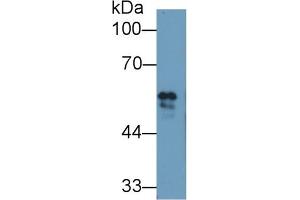 Detection of FGB in Bovine Serum using Polyclonal Antibody to Fibrinogen Beta Chain (FGB) (Fibrinogen beta Chain 抗体  (AA 49-495))