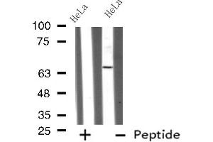 Western blot analysis GRK4 using HeLa whole cell lysates (GRK4 抗体  (N-Term))