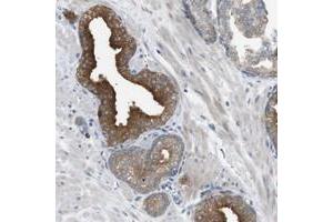 Immunohistochemical staining of human prostate with B4GALNT2 polyclonal antibody  shows strong cytoplasmic positivity in glandular cells. (B4GALNT2 抗体)