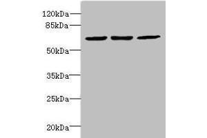 Western blot All lanes: INTS11 antibody at 2 μg/mL Lane 1: Colo320 whole cell lysate Lane 2: Hela whole cell lysate Lane 3: MCF-7 whole cell lysate Secondary Goat polyclonal to Rabbit IgG at 1/10000 dilution Predicted band size: 68, 57, 66, 65, 69 kDa Observed band size: 68 kDa (CPSF3L 抗体  (AA 331-600))