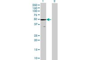 Western Blot analysis of ZCCHC3 expression in transfected 293T cell line by ZCCHC3 MaxPab polyclonal antibody. (ZCCHC3 抗体  (AA 1-403))