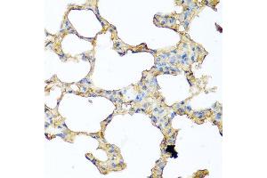 Immunohistochemistry of paraffin-embedded mouse lung using PIP antibody at dilution of 1:100 (40x lens). (PIP 抗体)