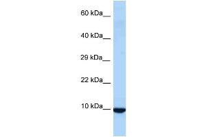 WB Suggested Anti-Id3 Antibody Titration: 1. (ID3 抗体  (Middle Region))