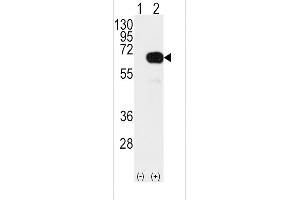 Western blot analysis of SD4 Antibody (arrow) using rabbit polyclonal SD4 Antibody  (ABIN392165 and ABIN2841882). (SMAD4 抗体  (AA 255-284))