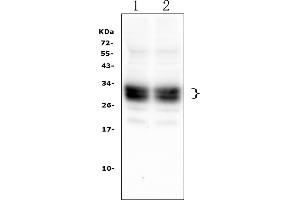 Western blot analysis of CD8A using anti-CD8A antibody (ABIN6719524). (CD8 alpha 抗体  (AA 27-114))