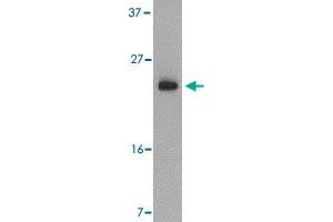 Western blot analysis of BBC3 expression in K-562 cell lysate with BBC3 polyclonal antibody  at 2 ug /mL .