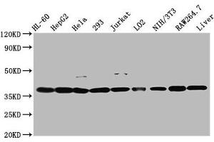 Western Blot Positive WB detected in: HL60 whole cell lysate, HepG2 whole cell lysate, Hela whole cell lysate, 293 whole cell lysate, Jurkat whole cell lysate, LO2 whole cell lysate, NIH/3T3 whole cell lysate, RAW264. (MDH1 抗体  (AA 1-334))