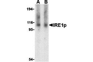 Western Blotting (WB) image for anti-Endoplasmic Reticulum To Nucleus Signaling 1 (ERN1) (Middle Region) antibody (ABIN1030962) (ERN1 抗体  (Middle Region))
