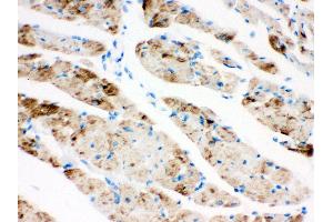 Anti- CPT1B Picoband antibody, IHC(P) IHC(P): Rat Cardiac Muscle Tissue (CPT1B 抗体  (N-Term))