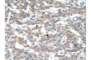 Immunohistochemistry (IHC) image for anti-Deoxyuridine Triphosphatase (DUT) (N-Term) antibody (ABIN2782437) (Deoxyuridine Triphosphatase (DUT) (N-Term) 抗体)