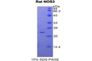 SDS-PAGE analysis of Rat NOS3 Protein. (ENOS 蛋白)