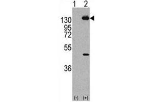 Western blot analysis of PDGFRA antibody and293 cell lysate (2 ug/lane) either nontransfected (Lane 1) or transiently transfected with the human gene (2).