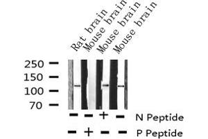 Western blot analysis of Phospho-Retinoblastoma (Ser807) expression in various lysates (Retinoblastoma 1 抗体  (pSer807))