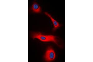 Immunofluorescent analysis of LT beta staining in HeLa cells. (LTB 抗体  (C-Term))