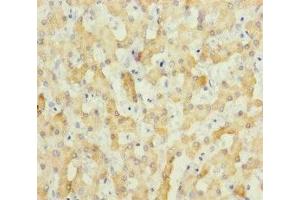 Immunohistochemistry of paraffin-embedded human liver tissue using ABIN7151803 at dilution of 1:100 (ECHS1 抗体  (AA 28-290))