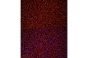 Immunofluorescence analysis of rat brain using STXBP1 antibody (ABIN6128255, ABIN6148673, ABIN6148674 and ABIN6221073) at dilution of 1:50. (STXBP1 抗体  (AA 295-594))