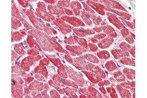 Anti-AK1 / Adenylate Kinase 1 antibody IHC staining of human heart. (Adenylate Kinase 1 抗体  (AA 108-157))