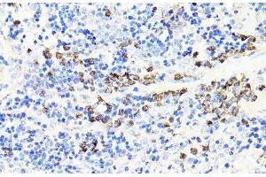 Immunohistochemistry (Paraffin-embedded Sections) (IHC (p)) image for anti-S100 Calcium Binding Protein A9 (S100A9) antibody (ABIN7264896)