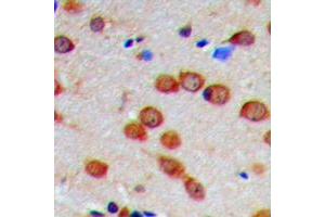 Immunohistochemical analysis of CaMK2 alpha/delta (pT286) staining in human brain formalin fixed paraffin embedded tissue section. (CaMK2 alpha/delta 抗体  (pSer286))