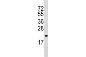 ARF5 antibody western blot analysis in Ramos lysate (ARF5 抗体  (AA 80-108))