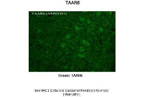 Researcher: Timur Mavlyutov, Ph. (TAAR6 抗体  (C-Term))