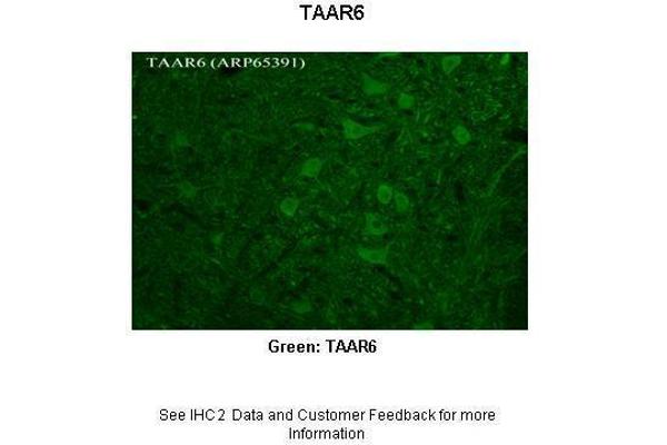 TAAR6 Antikörper  (C-Term)