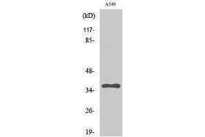 Western Blotting (WB) image for anti-Protein Phosphatase 2, Catalytic Subunit, alpha Isozyme (PPP2CA) (Thr278) antibody (ABIN3186532)
