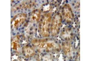 Used in DAB staining on fromalin fixed paraffin-embedded Kidney tissue (LGALS8 抗体  (AA 151-316))
