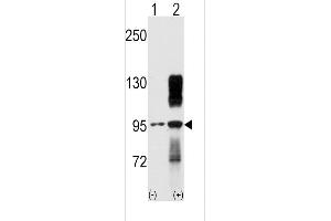 Western blot analysis of TYRO10 (arrow) using rabbit polyclonal TYRO10 Antibody (ABIN392069 and ABIN2841832). (DDR2 抗体)