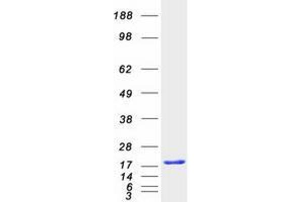 UBE2L3 Protein (Transcript Variant 1) (Myc-DYKDDDDK Tag)