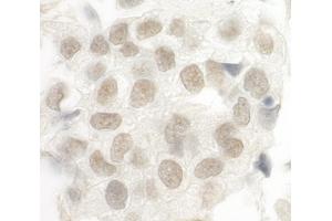 Immunohistochemistry (IHC) image for anti-Forkhead Box P1 (FOXP1) (AA 627-677) antibody (ABIN7448572) (FOXP1 抗体  (AA 627-677))