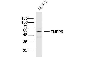 MCF-7 Cell lysates probed with ENPP6 Polyclonal Antibody, unconjugated (bs-13076R) at 1:300 overnight at 4°C followed by a conjugated secondary antibody for 60 minutes at 37°C. (ENPP6 抗体  (AA 251-350))