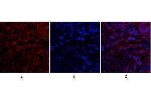 Immunofluorescence analysis of human lung tissue. (CXCL12 抗体  (C-Term))
