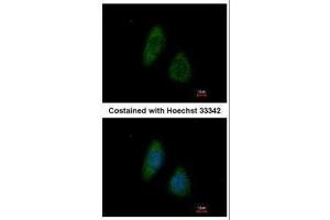 ICC/IF Image Immunofluorescence analysis of methanol-fixed HeLa, using BMP4, antibody at 1:200 dilution. (BMP4 抗体  (C-Term))