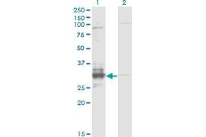Western Blot analysis of TFPI2 expression in transfected 293T cell line by TFPI2 monoclonal antibody (M01), clone 3E8.