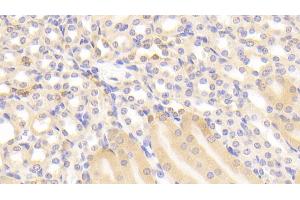 Detection of GSTp in Mouse Kidney Tissue using Polyclonal Antibody to Glutathione S Transferase Pi (GSTp) (GSTP1 抗体  (AA 1-210))