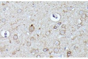 Immunohistochemistry of paraffin-embedded Rat brain using N-WASP Polyclonal Antibody at dilution of 1:100 (40x lens). (Neural Wiskott-Aldrich syndrome protein (WASL) 抗体)