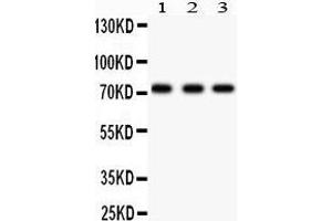 Anti- p73 antibody, Western blotting All lanes: Anti p73  at 0. (Tumor Protein p73 抗体  (AA 1-198))