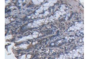 DAB staining on IHC-P; Samples: Mouse Colon Tissue (TOPBP1 抗体  (AA 1-246))