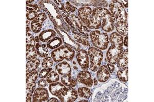 Immunohistochemical staining of human kidney with IFT80 polyclonal antibody  shows strong cytoplasmic positivity with a granular pattern in cells in tubules at 1:50-1:200 dilution. (IFT80 抗体)