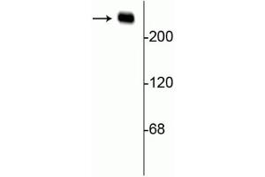 Western blot of rat hippocampal lysate showing specific immunolabeling of the ~240 kDa alpha II spectrin protein. (SPTAN1 抗体)