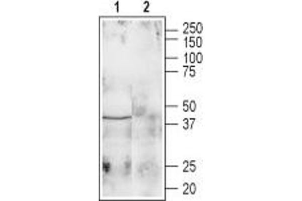 Galanin Receptor 1 抗体  (1st Extracellular Loop)