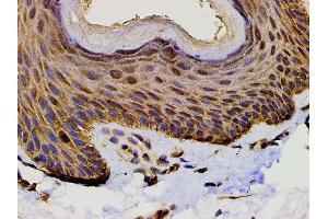 Immunohistochemistry (IHC) image for anti-Phosphoinositide 3 Kinase, p85 alpha (PI3K p85a) (pTyr607) antibody (ABIN6256775)