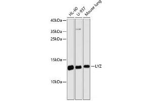 Western blot analysis of extracts of various cell lines using LYZ Polyclonal Antibody at dilution of 1:3000. (LYZ 抗体)