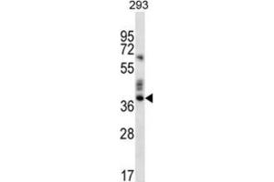 Western Blotting (WB) image for anti-Olfactory Receptor, Family 9, Subfamily K, Member 2 (OR9K2) antibody (ABIN2996627) (OR9K2 抗体)