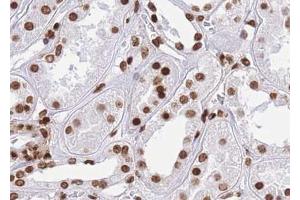 ABIN6267014 at 1/100 staining human kidney tissue sections by IHC-P. (CTBP1 抗体  (pSer422))