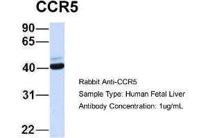 Host: Rabbit Target Name: CCR5 Sample Type: Human Fetal Liver Antibody Dilution: 1. (CCR5 抗体  (Middle Region))