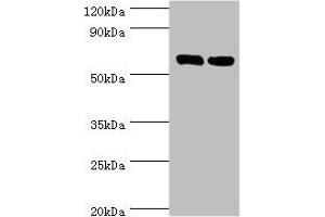 Western blot All lanes: TROVE2 antibody at 2 μg/mL Lane 1: Hela whole cell lysate Lane 2: 293T whole cell lysate Secondary Goat polyclonal to rabbit IgG at 1/10000 dilution Predicted band size: 61, 24, 59, 60 kDa Observed band size: 61 kDa (TROVE2 抗体  (AA 3-535))